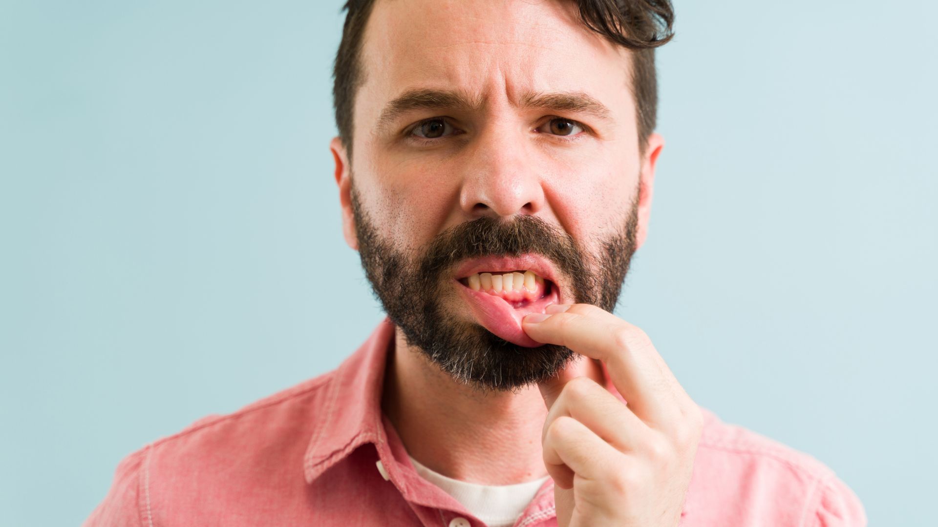 gingivitt og tannkjøttsykdom